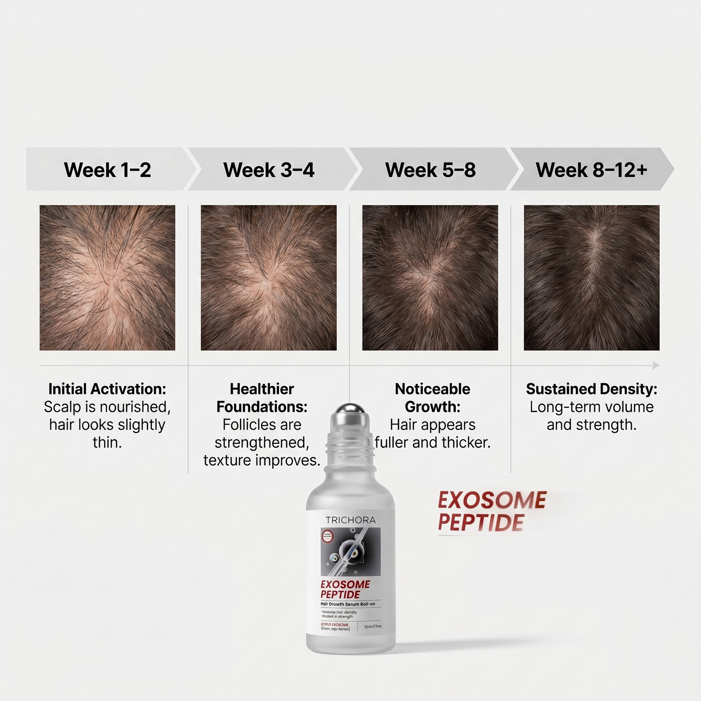 Trichora Exosome Peptide Serum